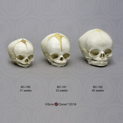 Human Fetal Skulls Set of 3