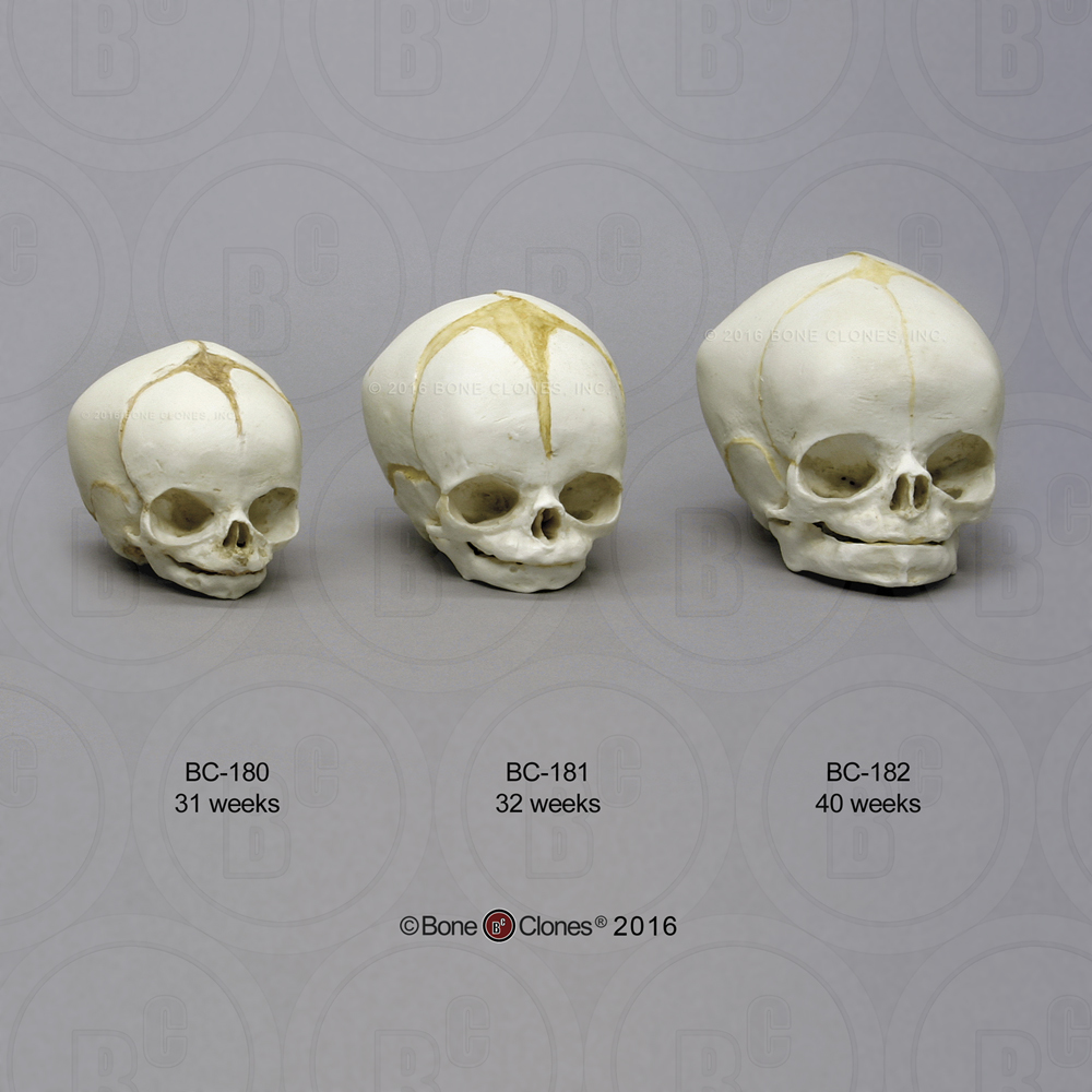Human Fetal Skulls Set of 3 - Bone Clones, Inc. - Osteological