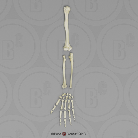 Human Female Asian Arm, Disarticulated without Scapula