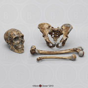 Neanderthal Skull Pelvis Femur and Humerus Set