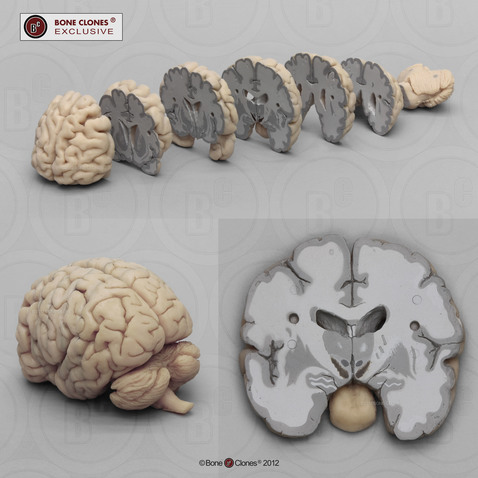 Human Brain Multiple Frontal Sections