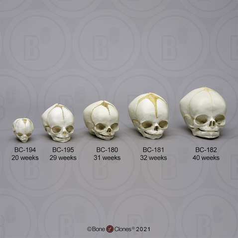 Human Fetal Skull Set of 5 Skulls