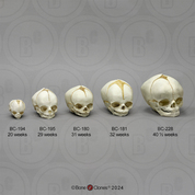 Human Fetal Skull Set of 5 Skulls