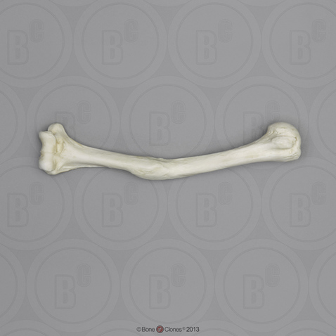 Human Left Humerus with Healed Distal Fracture