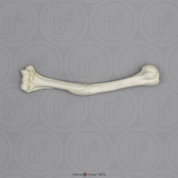 Human Left Humerus with Healed Distal Fracture