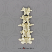 Human Female European Lumbar Vertebrae, set of 5