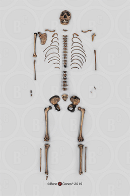 Disarticulated Homo ergaster Skeleton, KNM-WT 15000 "Nariokotome Boy"