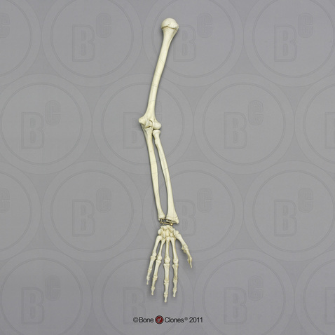 Human Adolescent Arm, Articulated w/Articulated Rigid Hand, (no Scapula)