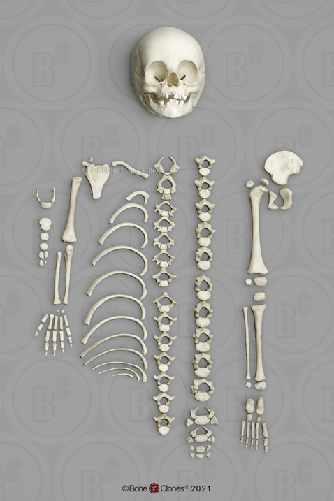 14 to 16-month-old Human Child Half Skeleton Disarticulated
