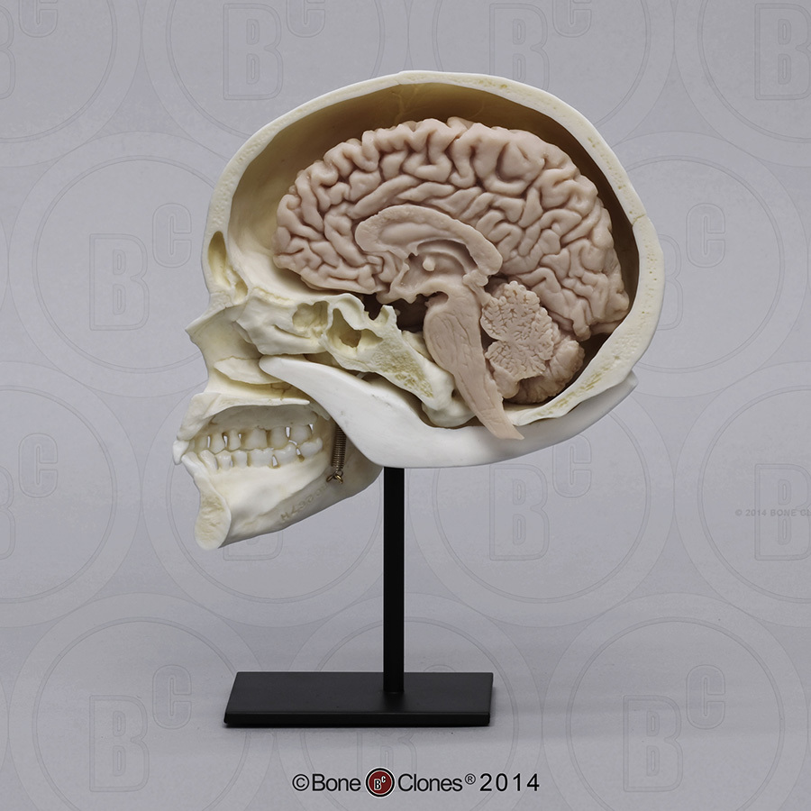 Human Sagittal Cut Half Skull with Brain Hemisphere - Bone Clones, Inc
