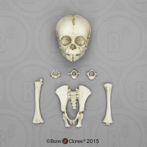 Fetal Chimpanzee Set of Skull and Postcranial Bones