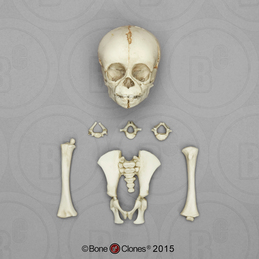 Fetal Chimpanzee Set of Skull and Postcranial Bones