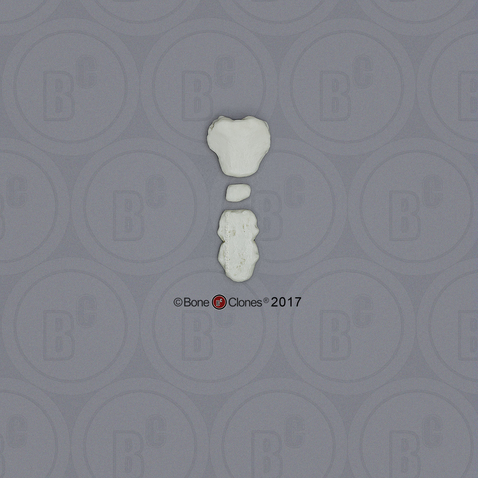 5-year-old Human Child Sternum