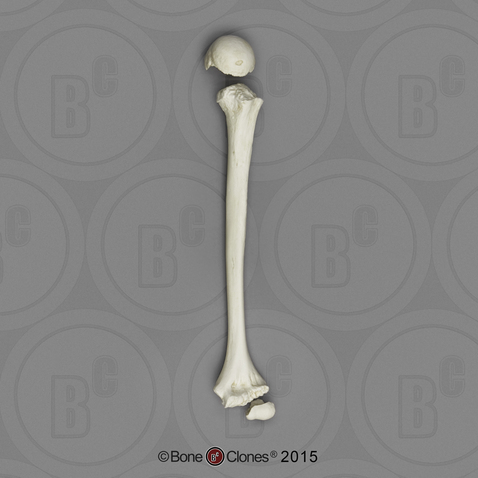 Human European American Male 13-year-old Humerus and Epiphysis - 3pcs