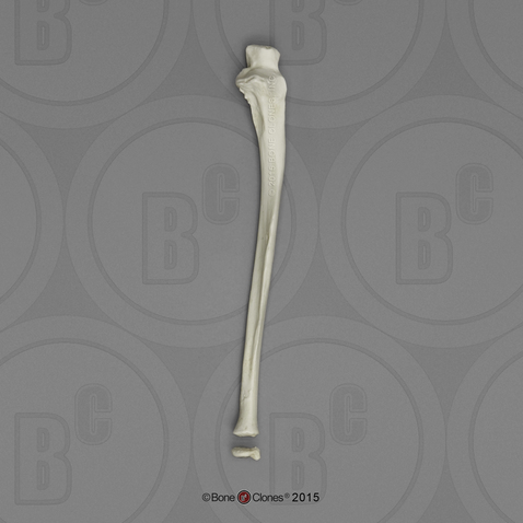 Human European American Male 13-year-old Ulna and Epiphysis -3pcs