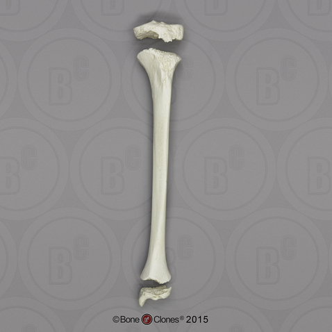 Human European American Male 13-year-old Tibia and Epiphysis - 3 pcs