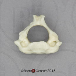 Human European American Male 13-year-old C-2 Vertebra