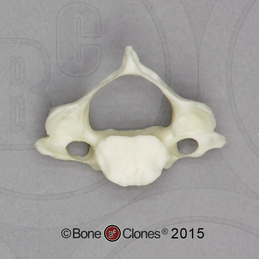 Human European American Male 13-year-old C-4 Vertebra