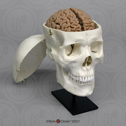 Human Sagittal Cut Half Skull with Brain Hemisphere - Bone Clones, Inc. -  Osteological Reproductions