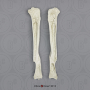 Human Right Tibia with Healed Fracture, Sagittal Cut