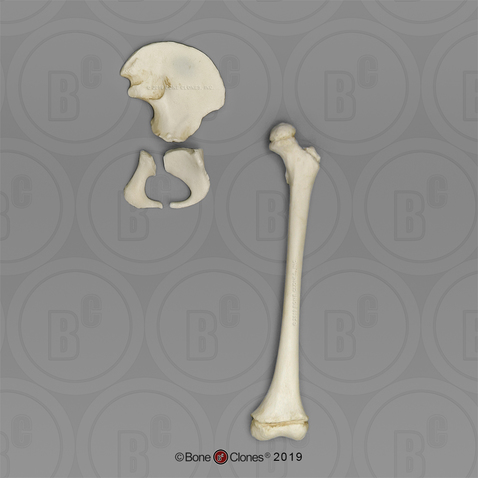 5-year-old Human Child Innominate, (3 pieces) and Femur Articulated