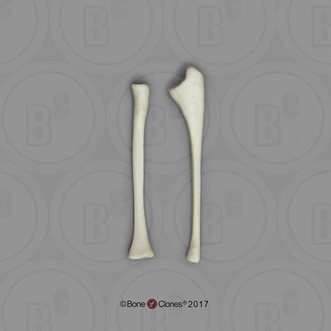 Human Child Radius and Ulna (L or R), 14 to 16-month-old