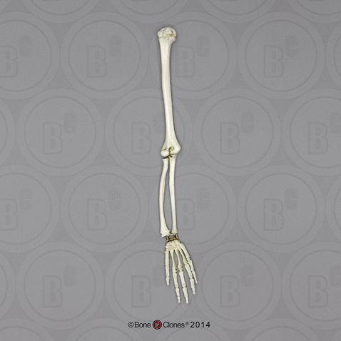 5-year-old Human Child, Arm, Articulated w/ Articulated Rigid Hand, (No Scapula)
