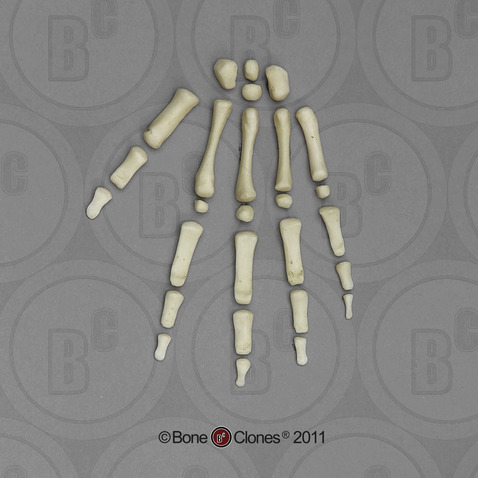 5-year-old Human Child Hand, Disarticulated