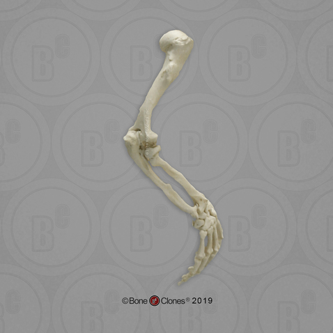 Human Female Achondroplasia Dwarf Arm, Articulated without Scapula