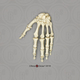 Human Female Achondroplasia Dwarf Hand, Articulated Rigid