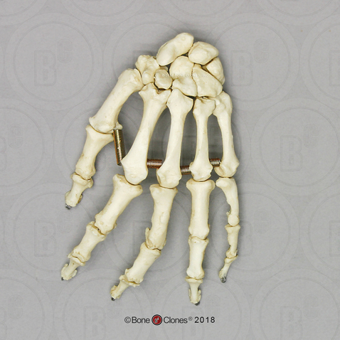 Human Female Achondroplasia Dwarf Hand, Articulated, Premium Flexible