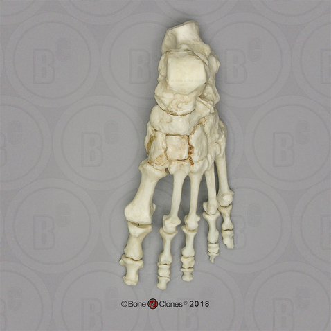 Human Female Achondroplasia Dwarf Foot, Articulated Rigid