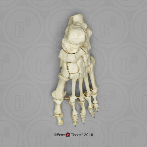 Human Female Achondroplasia Dwarf Foot, Articulated, Premium Flexible