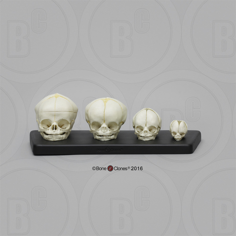 Human Fetal Skulls Set of 4 with Lesson Plan