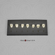 The Turner-Scott Dental Anthropology System - Shoveling Upper Incisor 1 Dental Plaque