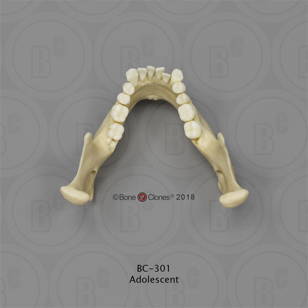 Human Jaw Set of 5 - Bone Clones, Inc. - Osteological Reproductions