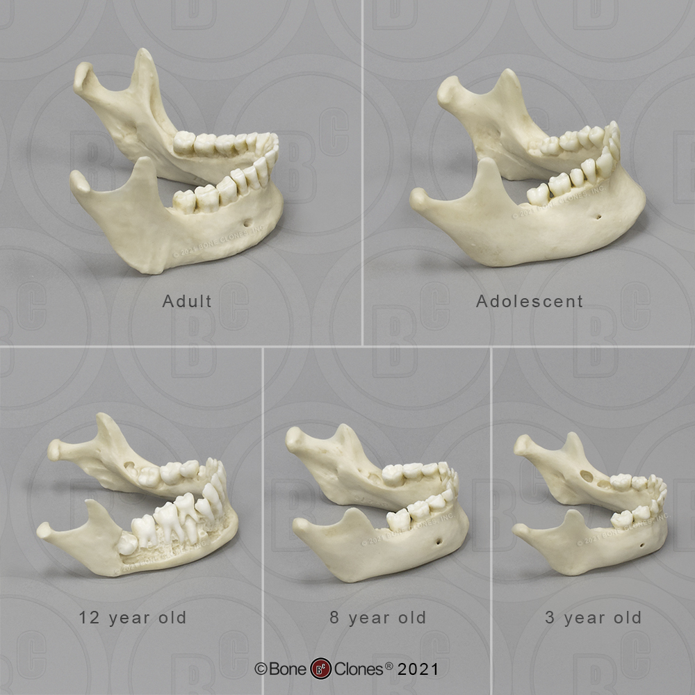 Human Jaw Set Of 5 Bone Clones Osteological Reproductions