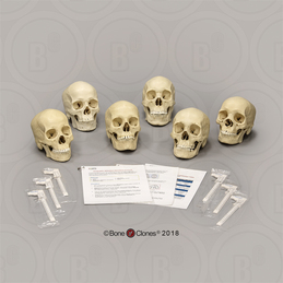 Human Sagittal Cut Half Skull with Brain Hemisphere - Bone Clones, Inc. -  Osteological Reproductions