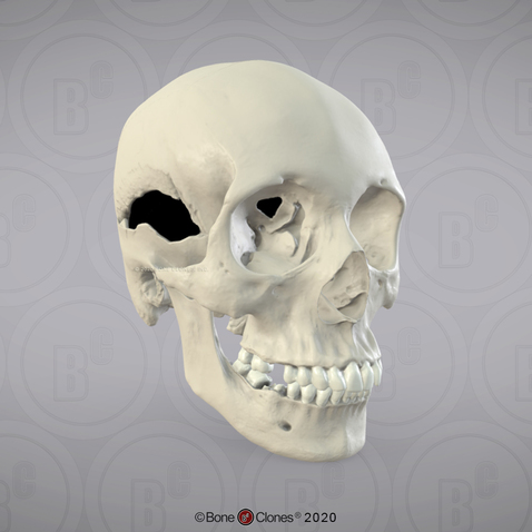 3D OsteoViewer - Human Skull with Multiple Gunshot Wounds, Female