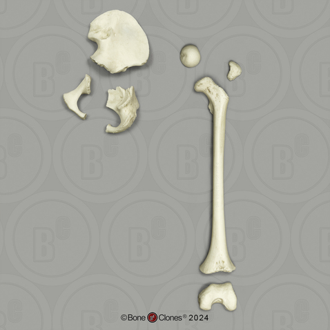 Human Child 6-year-old Innominate and Femur Set