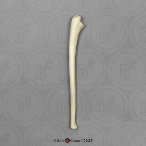 Human Child 6-year-old Ulna