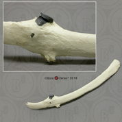 Human Rib with Embedded Bullet