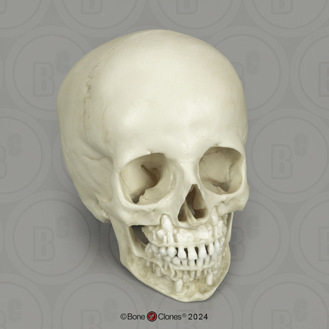 6-year-old Human Child Skull with Exposed Dentition