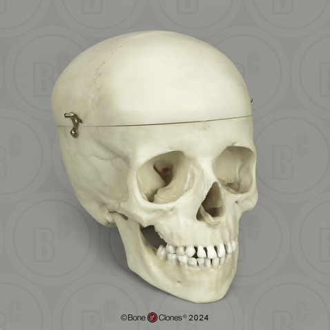 6-year-old Human Child Skull with Calvarium Cut