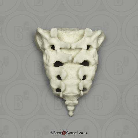 Human Child 6-year-old Sacrum and Coccyx Assembled