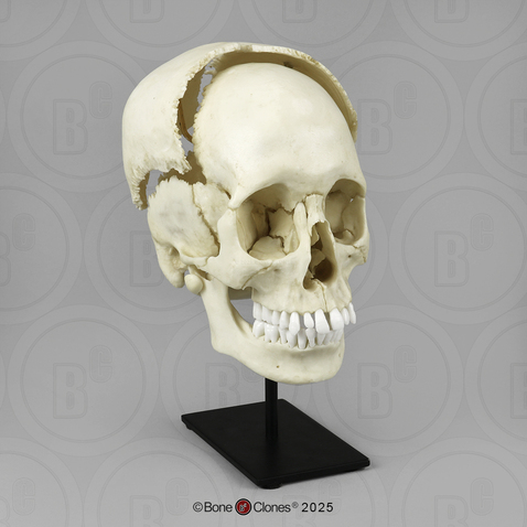 Human Medical Study Skull, Articulated