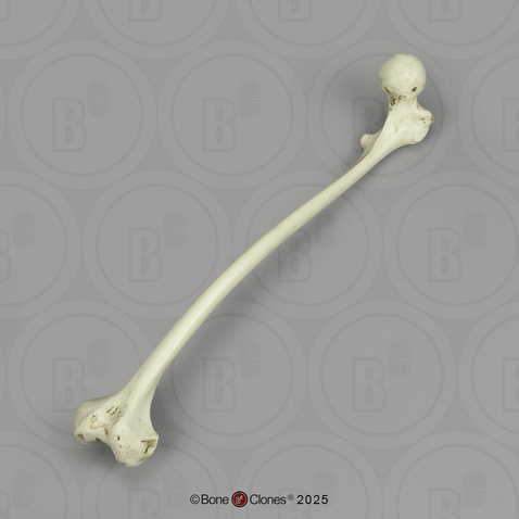 Human Left Femur, Polio