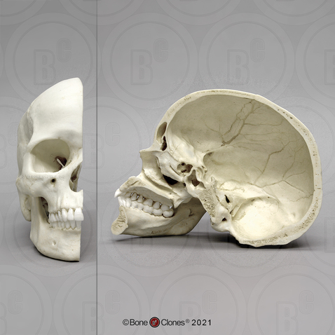 Human Skull Anatomy, Bones in Human Skull