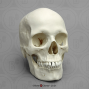 Male Human Skull with Brain and Stand - Bone Clones, Inc