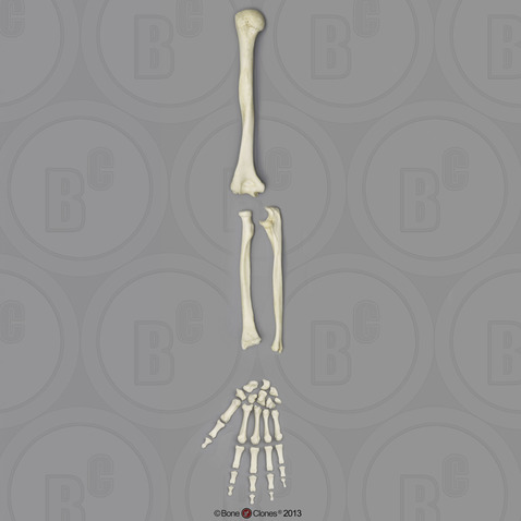 Human Male Asian Robust Arm, Disarticulated w/Disarticulated Hand (no scapula)